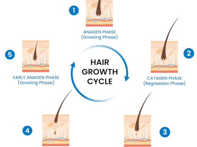 Minoxidil Hair Growth Topical Solution 5%