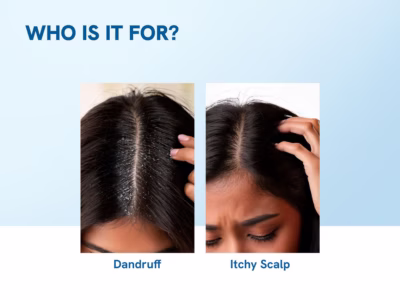 1% Ketoconazole Dandruff Shampoo