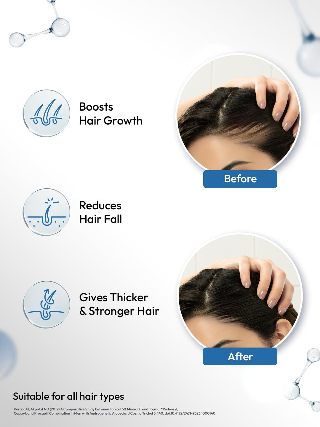 Scalpe Pro Hair Growth Serum with Applicator
