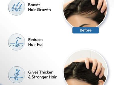 Scalpe Pro Hair Growth Serum with Applicator