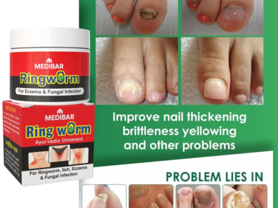 Antifungal Nail Cream Medibar