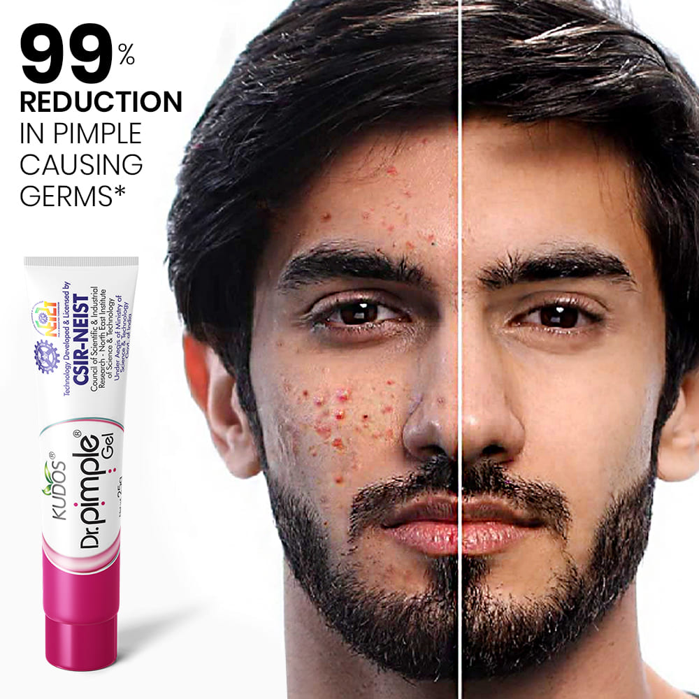 KUDOS Dr. Pimple Kit - Image 8