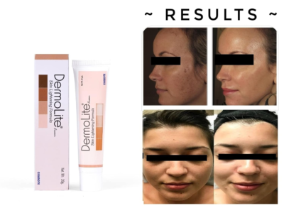 Dermolite Skin Lightening Cream