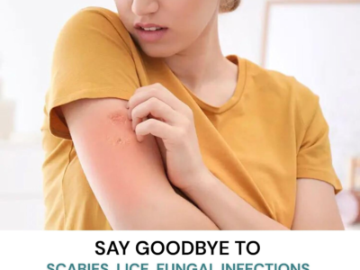 Anti Fungal & Anti Bacterial Permethrin Medicated Scabit Soap For both Men & Women For Good Hygiene