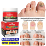 Antifungal Nail Cream Medibar