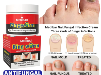 Antifungal Nail Cream Medibar