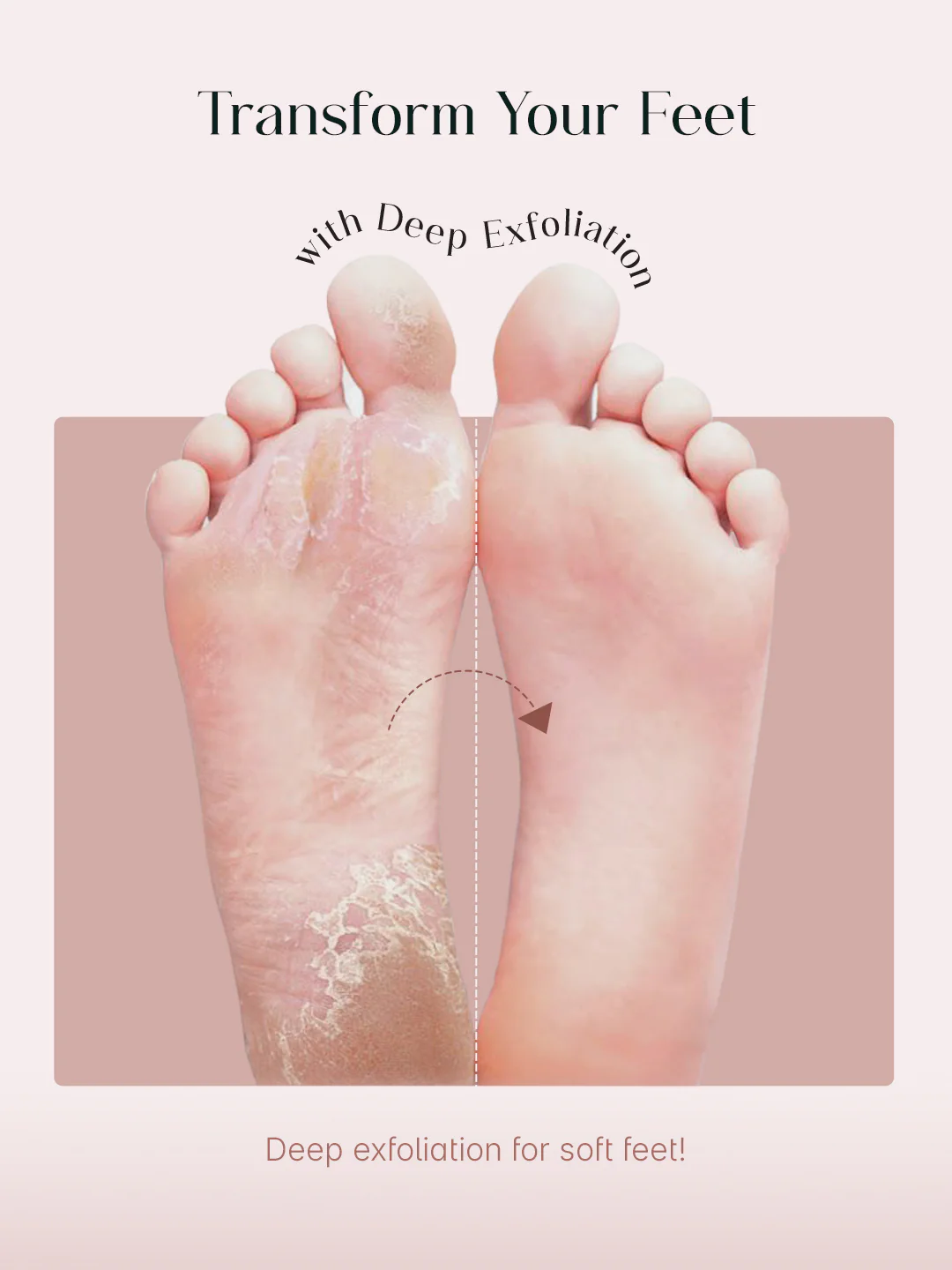 SeoulSkin Glycolic Acid Foot Peeling Mask