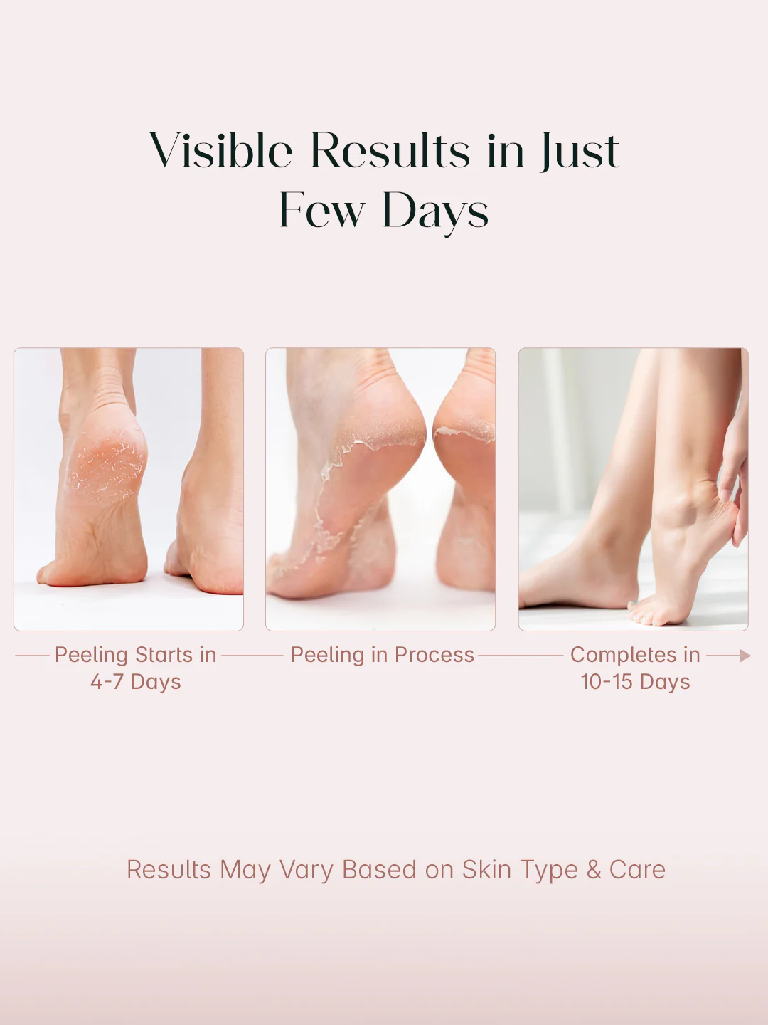 SeoulSkin Glycolic Acid Foot Peeling Mask - Image 4