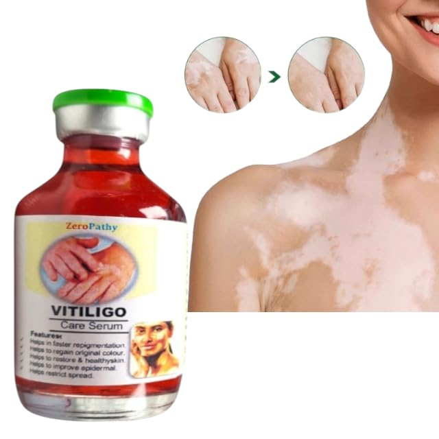 Vitiligo Gel White Spot Clear Anti Vitiligo cream - Image 4