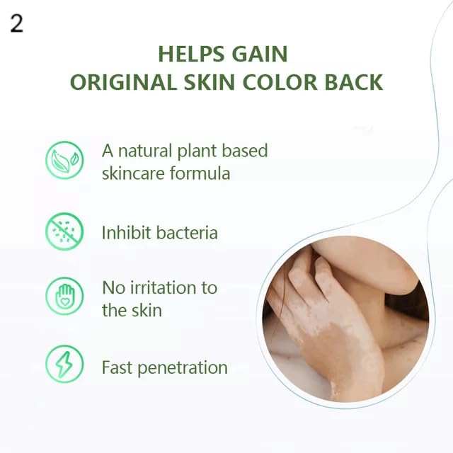 Vitiligo Gel White Spot Clear Anti Vitiligo cream - Image 5