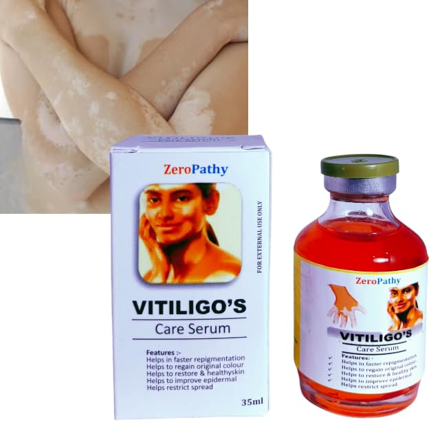 Vitiligo Gel White Spot Clear Anti-Vitiligo cream Safed Daag