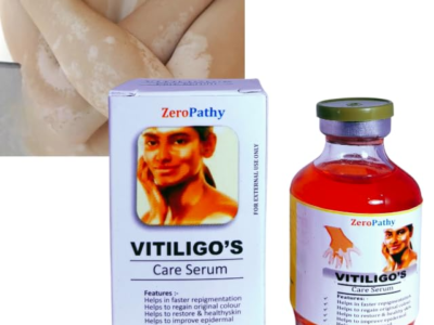 Vitiligo Gel White Spot Clear Anti Vitiligo cream Safed Daag