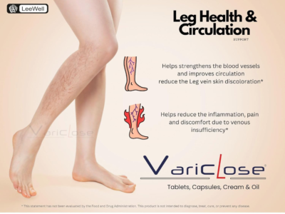 Varicose Vein Support and Restless Legs Circulation Flow