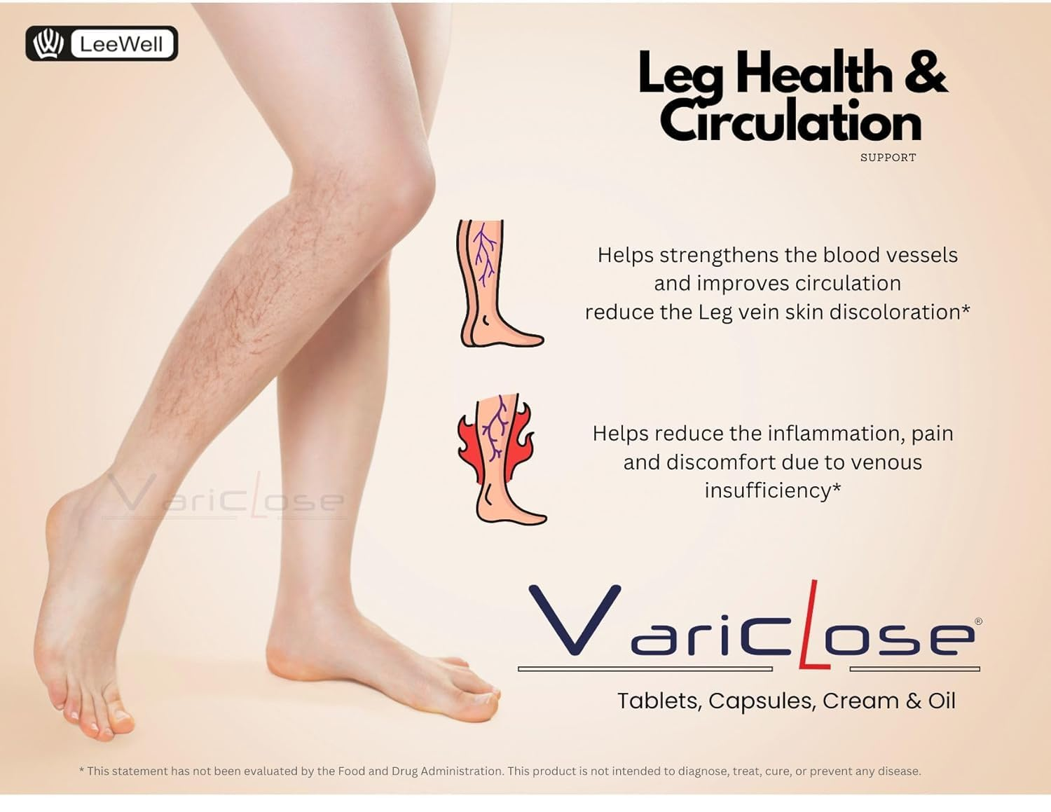 Varicose Vein Support and Restless Legs Circulation Flow