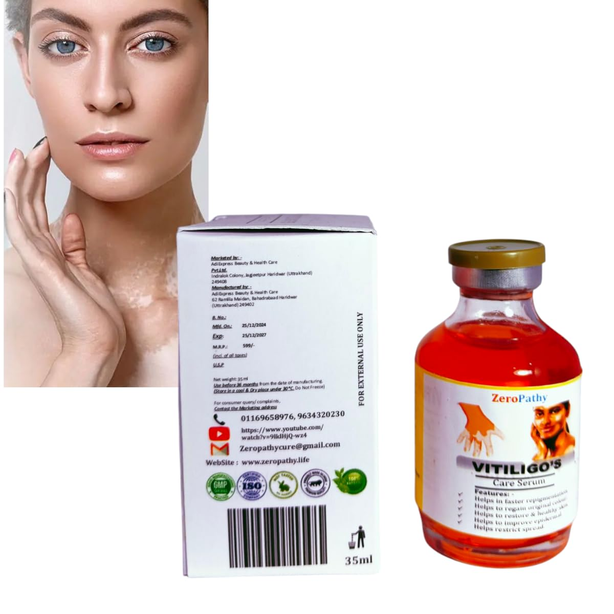 Vitiligo Gel White Spot Clear Anti Vitiligo cream - Image 8