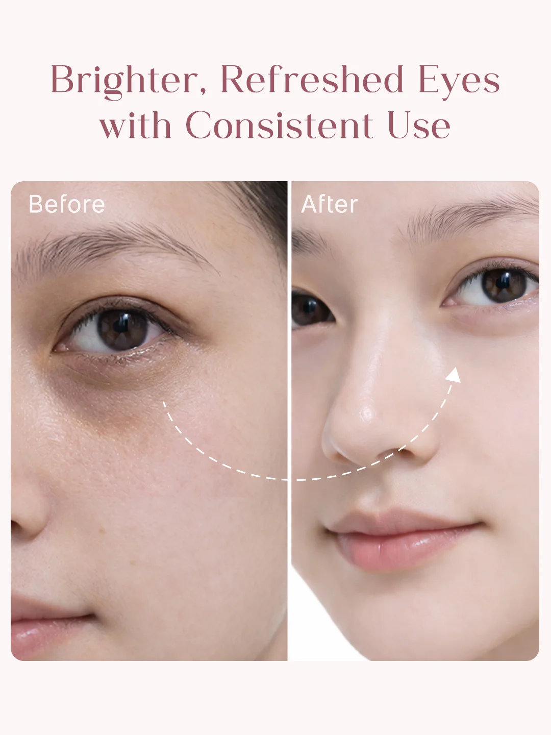 Seoulskin Under Eye Cream - Image 4