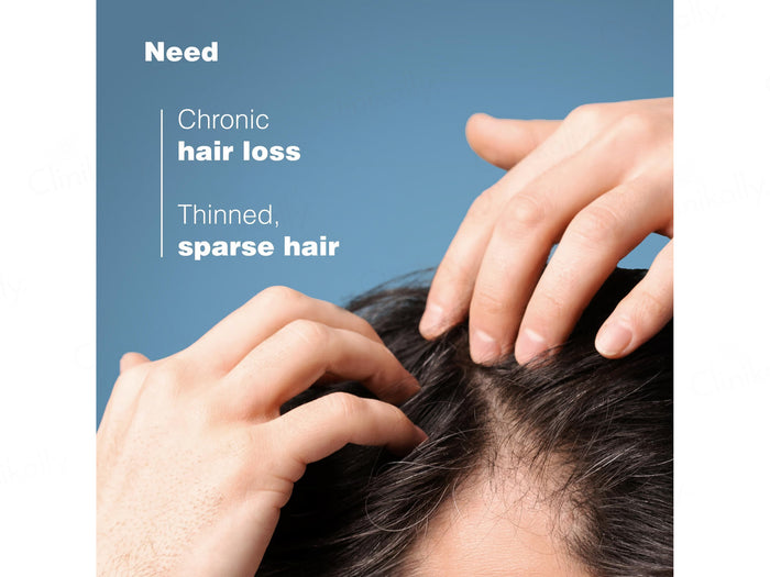 Ducray Anaphase Anti-Hair Loss Anti-Thinning Shampoo - Image 8