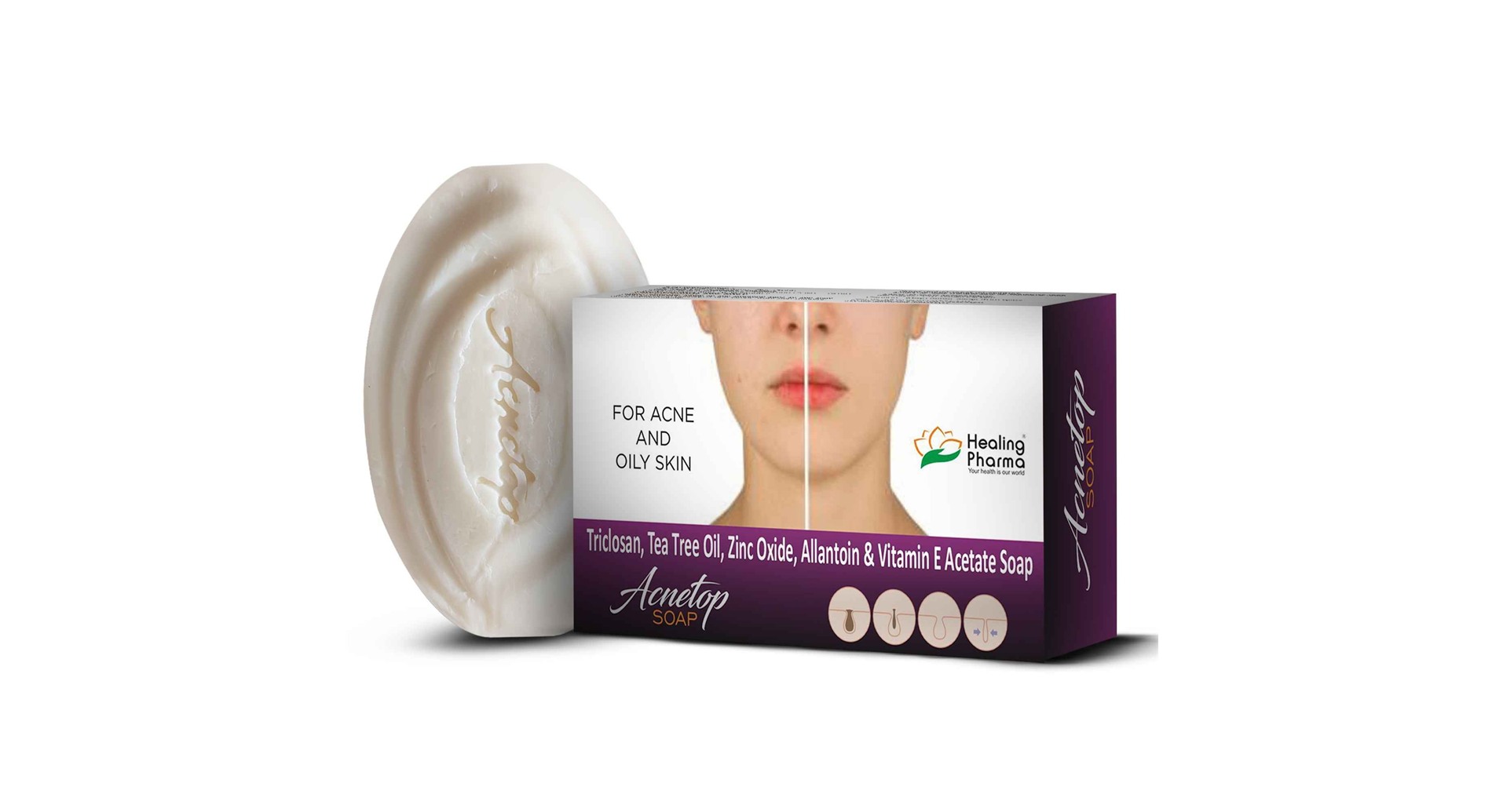 Healing Pharma Acnetop Soap - Image 3