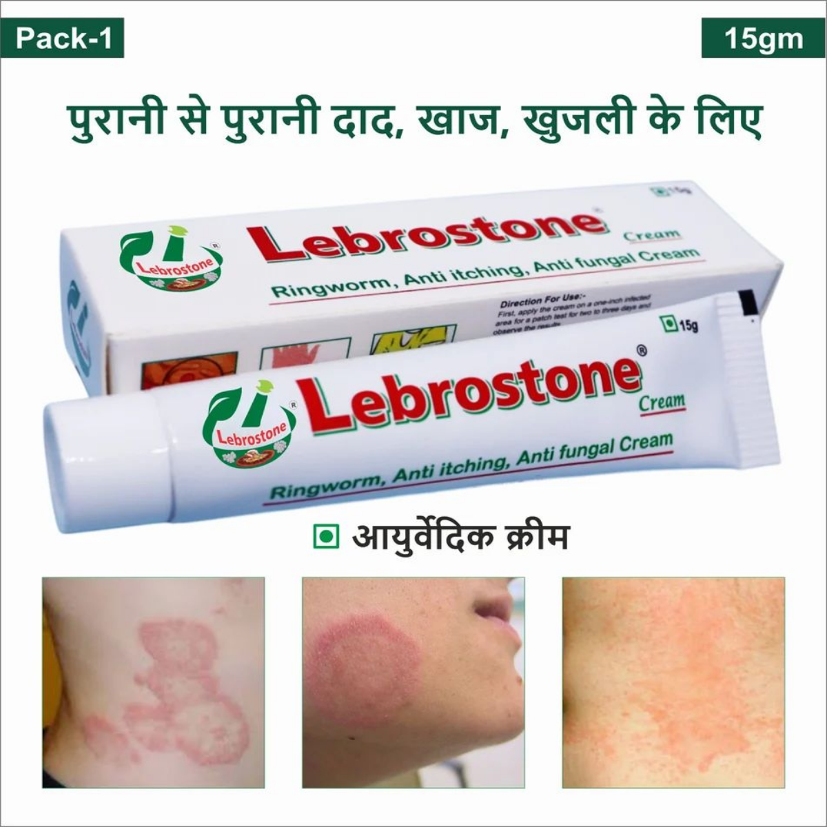 Lebrostone Cream 15 g pack for ringworm, anti-itching and anti-fungal relief