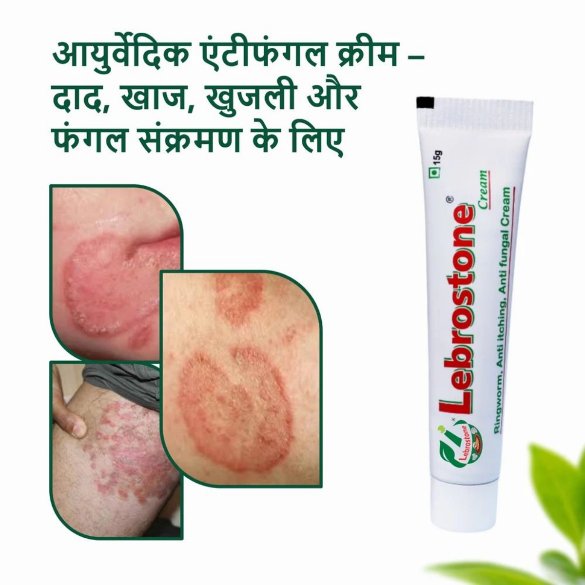 Lebrostone Ayurvedic anti-fungal cream 15 g tube for ringworm