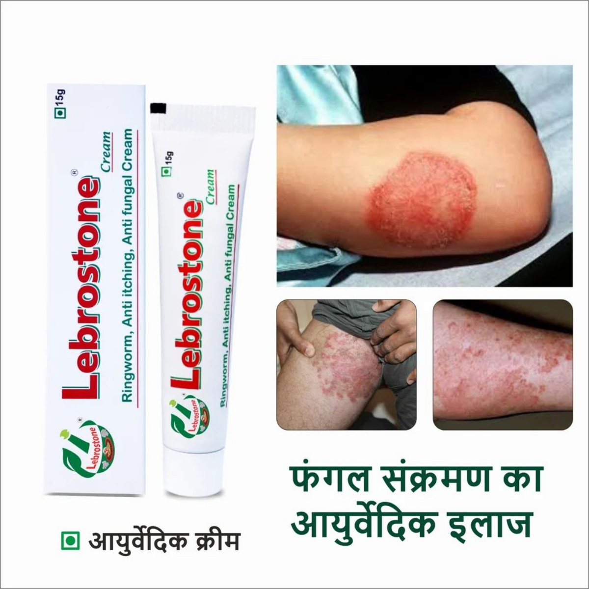 Lebrostone Cream carton and tube for fungal skin infection