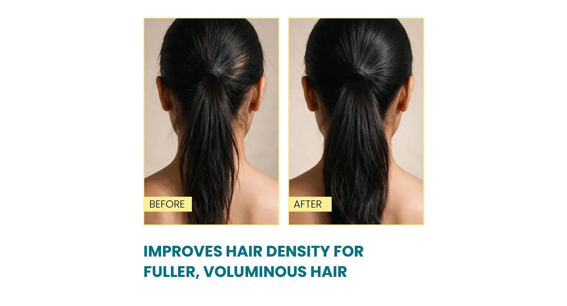 Zeelab Minoxil Pro Hair Growth Serum before and after results