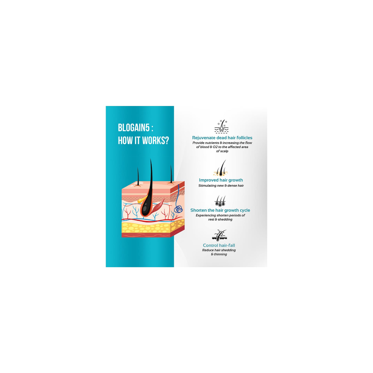 Blogain-5 Hair Growth Topical Solution