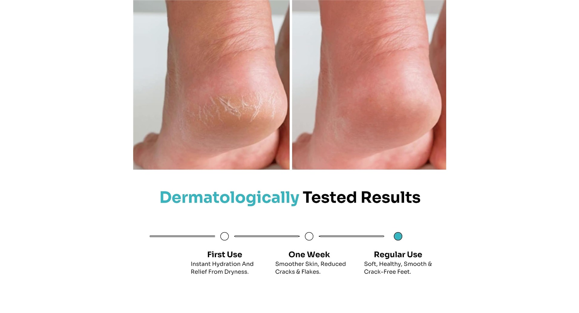 Kitcoz Foot Cream Roll On