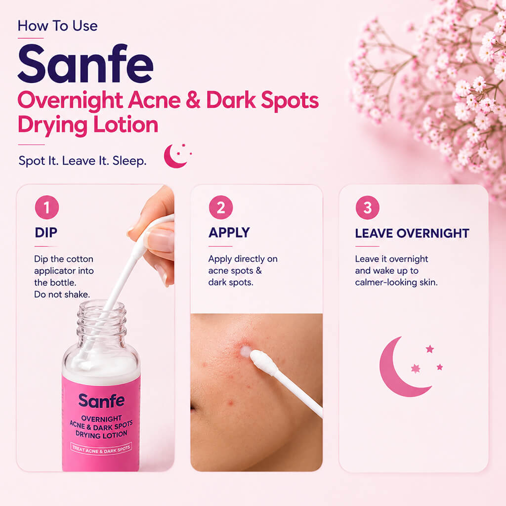 Sanfe Overnight Acne and Dark Spots Drying Lotion 20ml