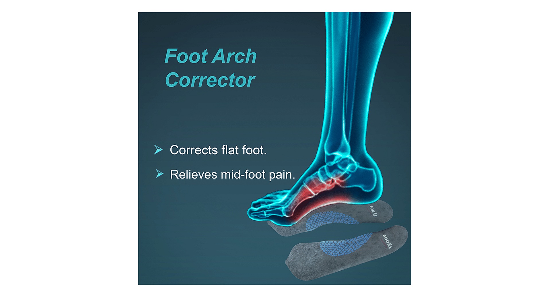 Tynor K-10 Medial Arch Orthosis